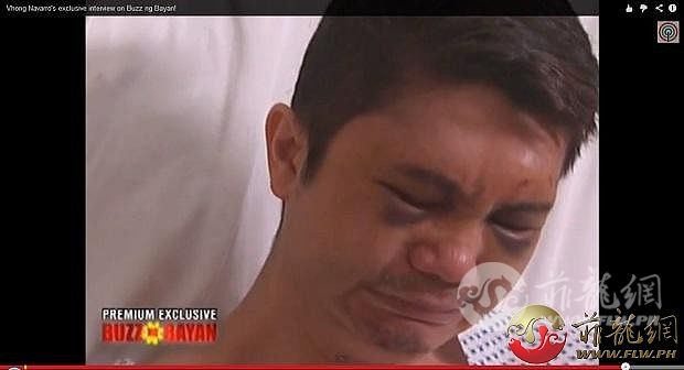 Vhong-Navarro-beaten-up.jpg